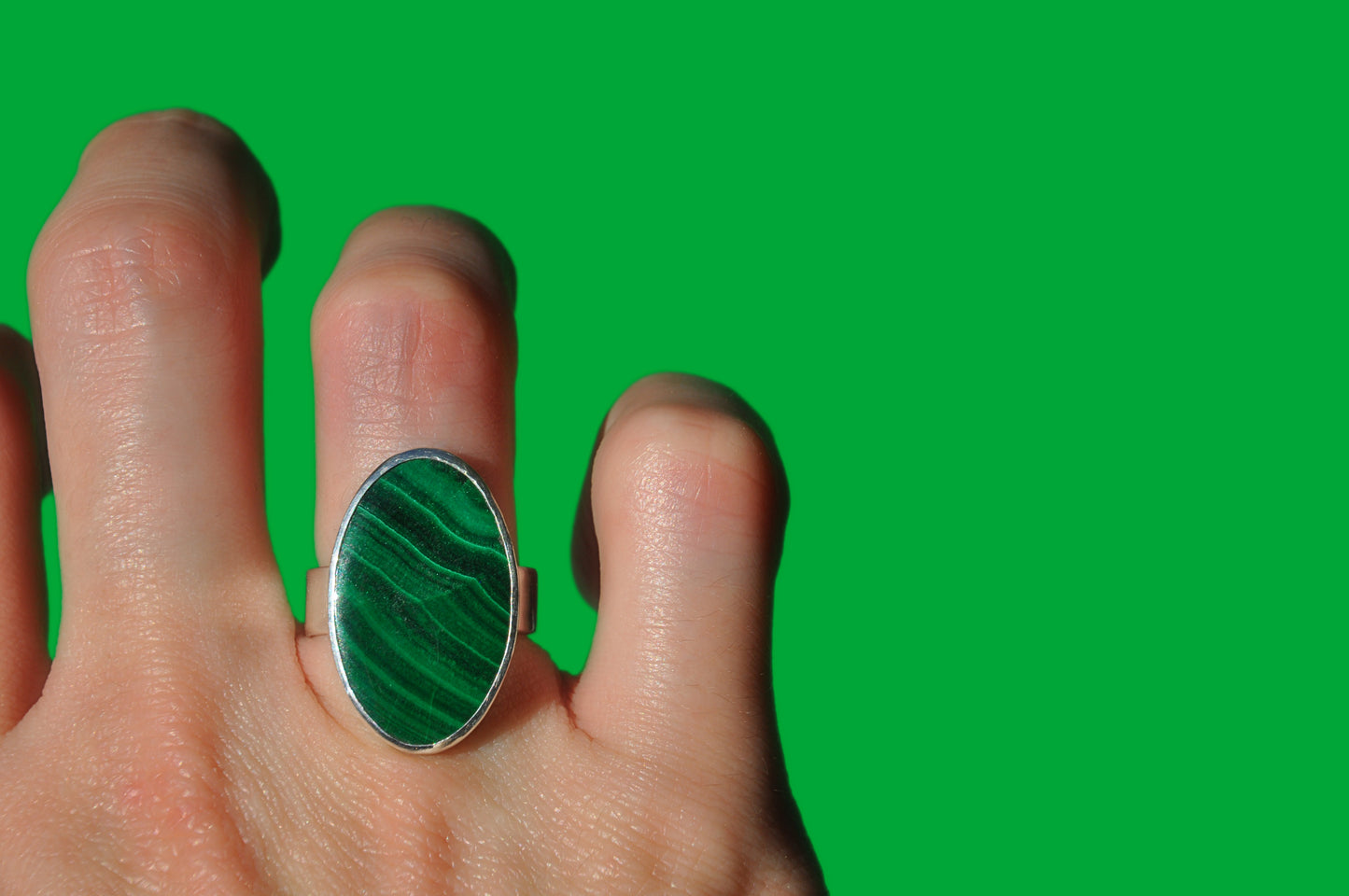 Malachite Ring